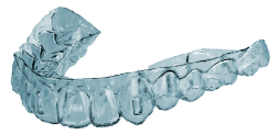 Digital Clear Aligner